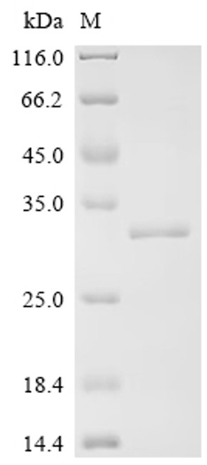 Recombinant Human Toll-like receptor 5 (TLR5), partial (CSB-EP023604HU)