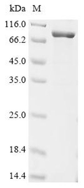Recombinant Rat CCN family member 4 (Ccn4), Biotinylated (CSB-EP857523RA-B)