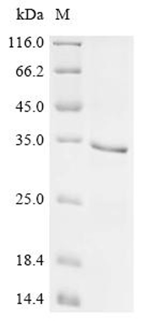 Recombinant Mouse Dickkopf-related protein 2 (Dkk2) (CSB-EP865601MO)