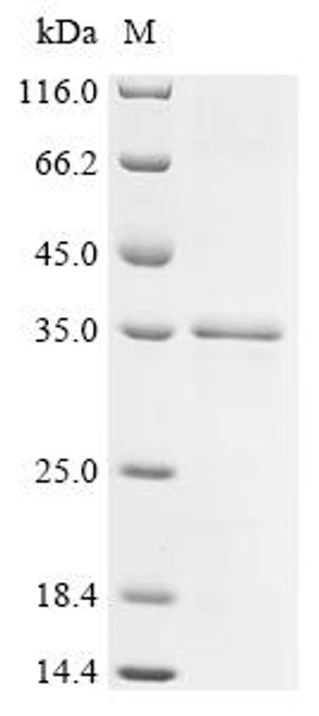 Recombinant Actinidia deliciosa Actinidain (CSB-EP402304AXF)