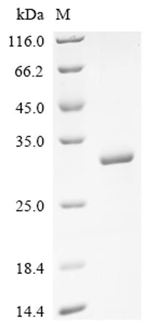 Recombinant Human E3 ubiquitin-protein ligase RNF182 (RNF182), partial (CSB-EP822714HU1)