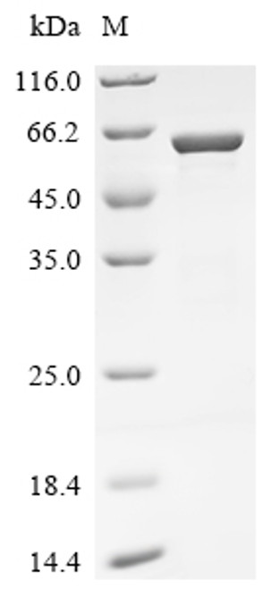 Recombinant Bat coronavirus HKU5 Nucleoprotein (N) (CSB-EP386462BOU)