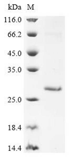 Recombinant Human Ropporin-1A (ROPN1) (CSB-BP888012HU)