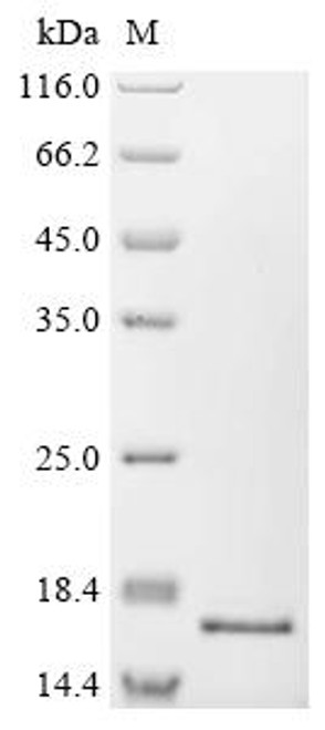 Recombinant Human C-Jun-amino-terminal kinase-interacting protein 4 (SPAG9), partial (CSB-BP022470HU)