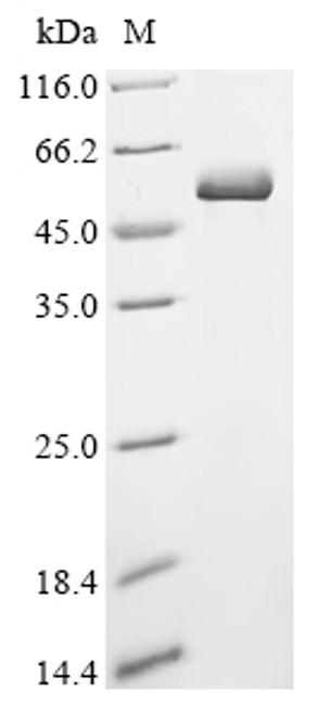Recombinant Human Tumor necrosis factor receptor superfamily member 5 (CD40), partial (CSB-BP004936HU1)