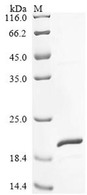 Recombinant Chicken Fibroblast growth factor 2 (FGF2) (CSB-BP008625CH)