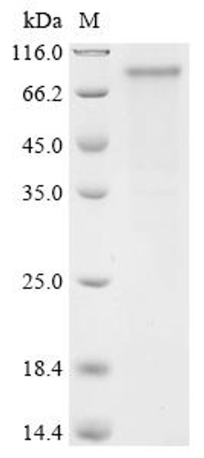 Recombinant Human PR domain zinc finger protein 8 (PRDM8) (CSB-BP889084HU)