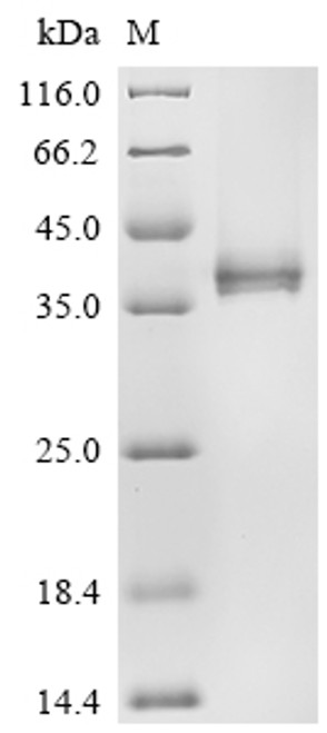 Recombinant Human Interleukin-12 receptor subunit beta-2 (IL12RB2), partial (CSB-BP859518HU1)