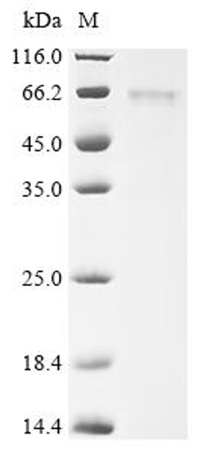 Recombinant Mouse C-type lectin domain family 18 member A (Clec18a) (CSB-BP759740MO)