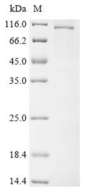 Recombinant Human Schlafen family member 11 (SLFN11) (CSB-BP021760HU(A4))