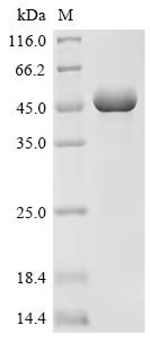 Recombinant Finegoldia magna ATCC 53516 LPXTG-motif cell wall anchor domain protein, partial, Biotinylated (Active) (CSB-EP5116GUR-B)