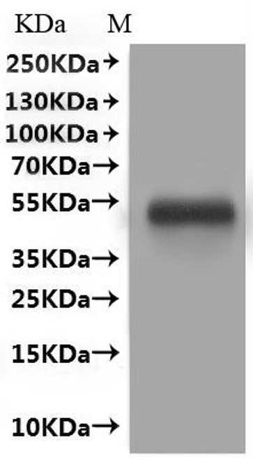 Recombinant Human Myelin-oligodendrocyte glycoprotein (MOG), Fluorescent-VLPs (CSB-MP619083HU(A4))