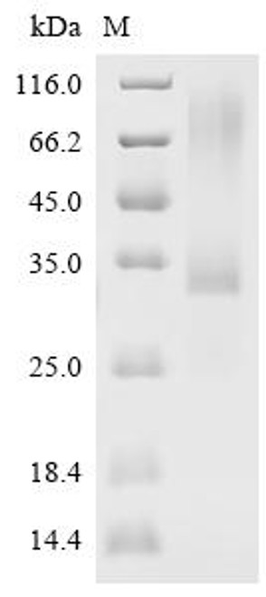 Recombinant Human Sclerostin (SOST), Biotinylated (CSB-MP858415HU-B)