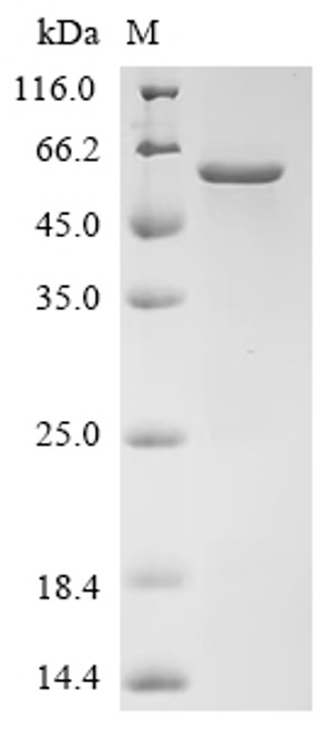 Recombinant Human Hepatic sodium/bile acid cotransporter (SLC10A1), partial, Biotinylated (CSB-EP623947HUg10-B)