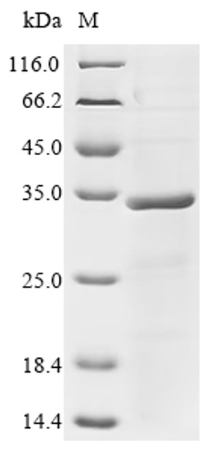 Recombinant Human Liver-expressed antimicrobial peptide 2 (LEAP2) (CSB-EP850245HUc0)
