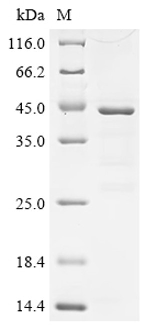Recombinant Human C-C motif chemokine 21 (CCL21) (CSB-EP004785HUc0)
