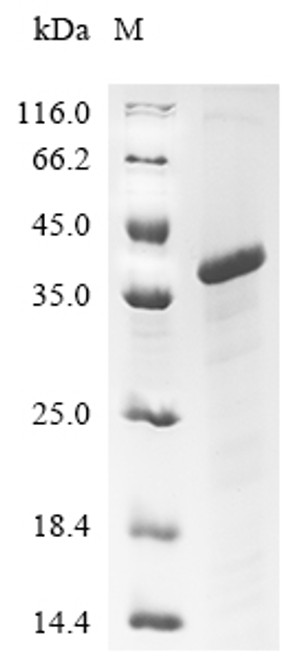 Recombinant Chicken Low-density lipoprotein receptor-related protein 1 (LRP1), partial (CSB-EP013091CH)