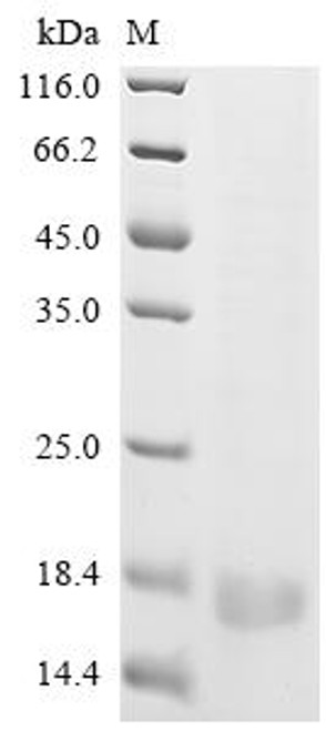 Recombinant Human cytomegalovirus Uncharacterized protein UL131 (UL131) (CSB-EP323723HWVc7)