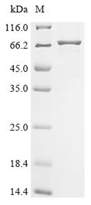 Recombinant Coxiella burnetii Hypothetical membrane spanning protein (CBU_1863), partial (CSB-EP4560DXP6)