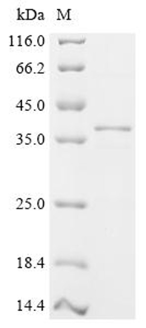 Recombinant Mouse Deoxyribonuclease gamma (Dnase1l3), partial (CSB-EP007052MO1)
