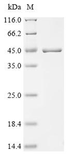 Recombinant Qbeta virus Minor capsid protein A1 (CSB-EP528941ELC) Recombinant Qbeta virus Minor capsid protein A1 (CSB-EP528941ELC)