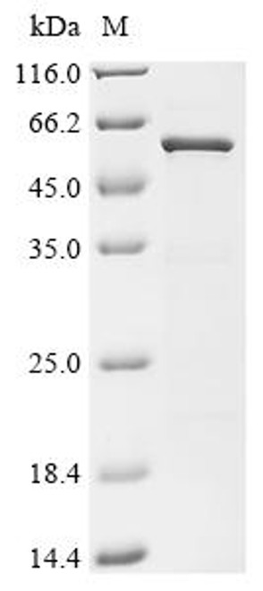 Recombinant Bat coronavirus HKU4 Nucleoprotein (N) (CSB-EP387608BOT)