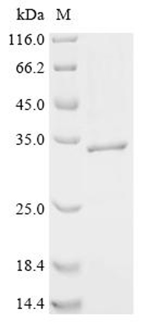 Recombinant Coxiella burnetii Uncharacterized protein CBU_1260 (CSB-EP770956DXP) Recombinant Coxiella burnetii Uncharacterized protein CBU_1260 (CSB-EP770956DXP)