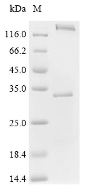 Recombinant Human herpesvirus 6A Envelope glycoprotein H (gH), partial (CSB-EP303717HJZ1a2)
