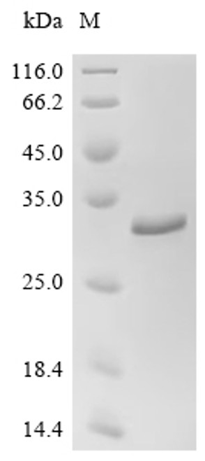Recombinant Chlamydia pneumoniae Large cysteine-rich periplasmic protein OmcB (omcB), partial (CSB-EP326426DRZc7) Recombinant Chlamydia pneumoniae Large cysteine-rich periplasmic protein OmcB (omcB), partial (CSB-EP326426DRZc7)
