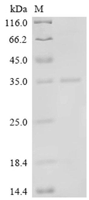 Recombinant Human Vascular endothelial growth factor A (VEGFA) (CSB-EP025833HU)