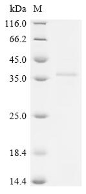Recombinant Human herpesvirus 6B Envelope glycoprotein H (gH), partial (CSB-EP346768HKA1) Recombinant Human herpesvirus 6B Envelope glycoprotein H (gH), partial (CSB-EP346768HKA1)