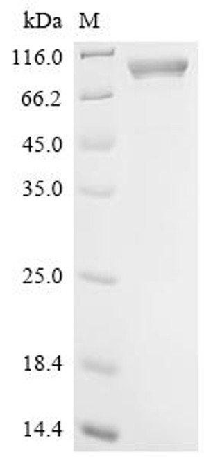 Recombinant BK polyomavirus Major capsid protein VP1, Biotinylated (CSB-EP360953BGY-B)