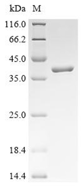 Recombinant Escherichia coli O127:H6 Intimin (eae), partial (CSB-EP324852EOB)