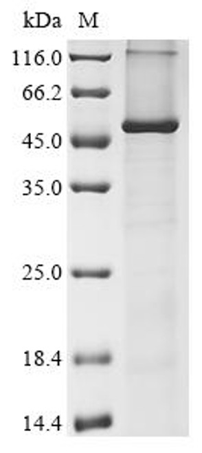 Recombinant Human Acyl-CoA 6-desaturase (FADS2) (CSB-CF007960HU(A4))