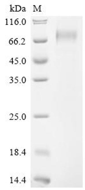 Recombinant Mesocricetus auratus Interferon alpha/beta receptor 1 (Ifnar1), partial (CSB-MP5445MRG)
