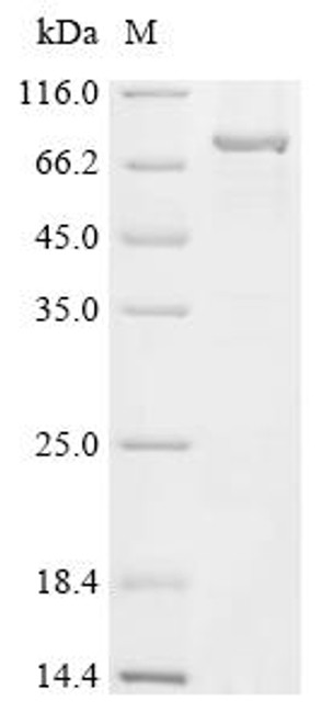 Recombinant Mouse Polypeptide N-acetylgalactosaminyltransferase 3 (Galnt3) (CSB-CF009210MO)