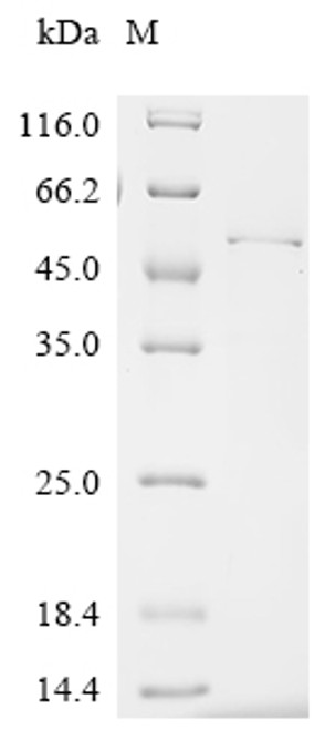 Recombinant Mouse Interferon regulatory factor 1 (Irf1) (CSB-EP011814MO)