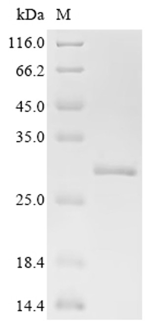 Recombinant Mouse Serum amyloid A-3 protein (Saa3), partial (CSB-EP361411MOa2)