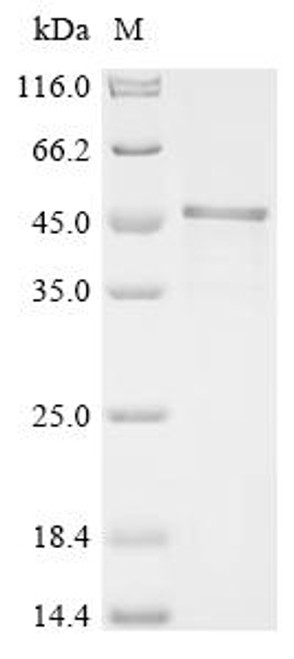 Recombinant Human Y-box-binding protein 3 (YBX3) (CSB-EP006037HU)