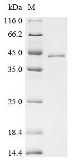 Recombinant Mumps virus Hemagglutinin-neuraminidase (HN), partial, Biotinylated (CSB-EP323149MJM2-B)