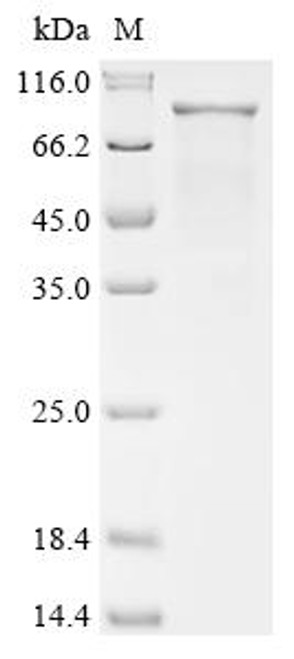 Recombinant Human Segment polarity protein dishevelled homolog DVL-1 (DVL1) (CSB-EP007284HU)
