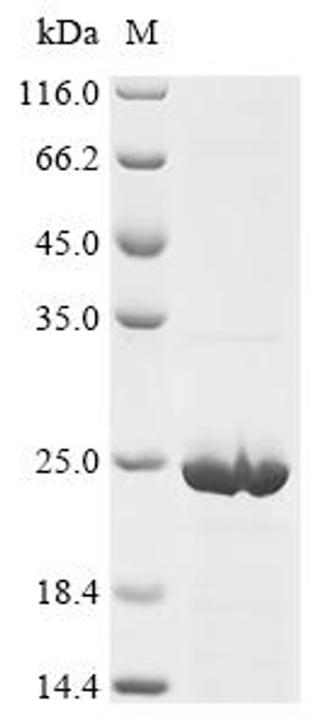 Recombinant Mouse Gamma-synuclein (Sncg) (CSB-EP5197MO)