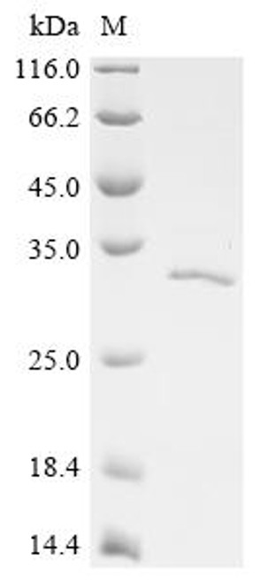 Recombinant Human Tyrosine-protein phosphatase non-receptor type 14 (PTPN14), partial (CSB-EP623010HU)