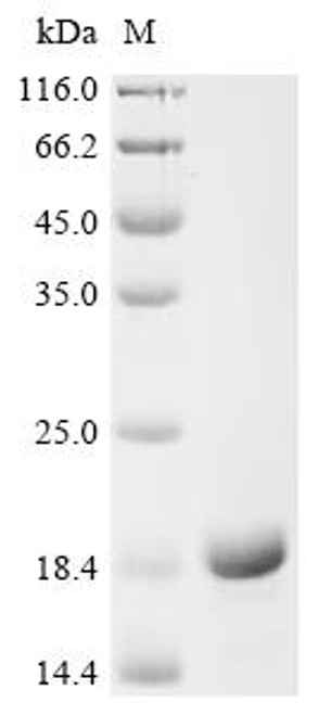 Recombinant Human Protein S100-P (S100P) (CSB-EP020645HU)