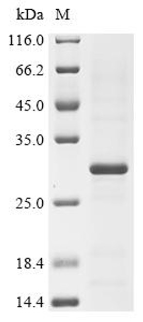 Recombinant Dermatophagoides pteronyssinus Mite allergen Der p 3 (DERP3) (CSB-EP331059DJHe1)