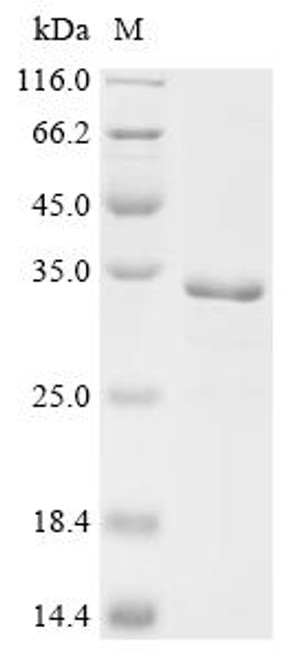 Recombinant Mouse Peroxisomal coenzyme A diphosphatase NUDT7 (Nudt7) (CSB-EP857515MO)