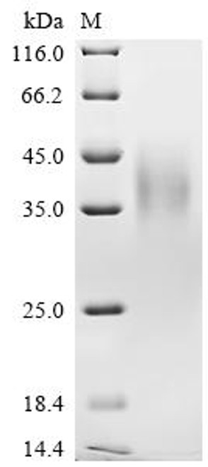 Recombinant Human V-type immunoglobulin domain-containing suppressor of T-cell activation (VSIR), partial, Biotinylated (CSB-MP884484HU-B)