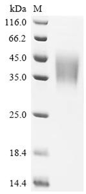 Recombinant Human Low affinity immunoglobulin gamma Fc region receptor III-B (FCGR3B), partial (CSB-MP008544HU)