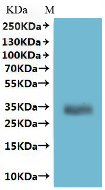 Recombinant Human Melanocyte-stimulating hormone receptor (MC1R)-VLPs (CSB-MP086369HU)