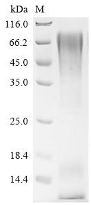 Recombinant Human Mucin-1 (MUC1), partial, Biotinylated (CSB-MP015215HU3-B)